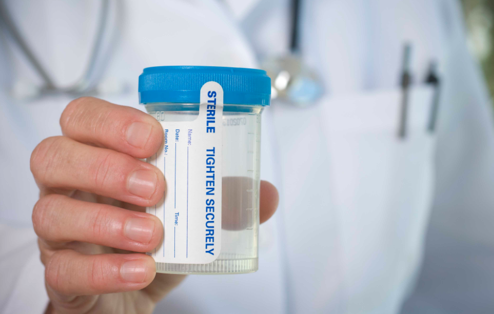 URINE DRUG TESTING – Rapid Screening Services